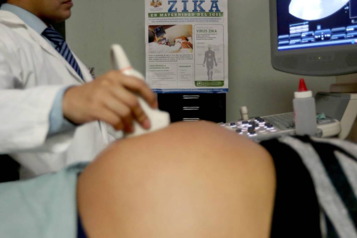 En Santander hay 21 mujeres embarazadas que tienen diagnóstico confirmado de zika.